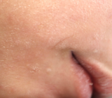 The Ultimate Winter Skincare Survival Guide: How to Stop Dry, Red, and Flaky Skin